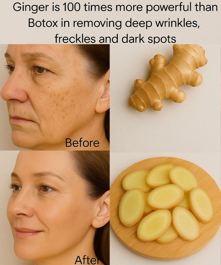 Embrace Youthful Skin with Ginger 