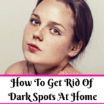 How To Get Rid Of Dark Spots With Home Remedies [Overnight]
